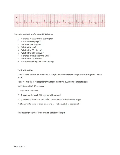 EKG Packet Interactive Worksheet Edform